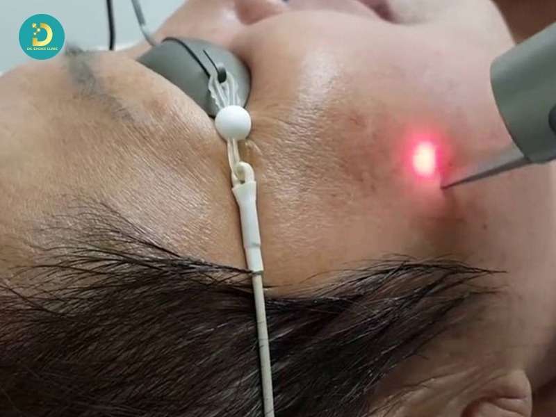 Các phương pháp thường được áp dụng trong điều trị nám da, tàn nhang, đồi mồi