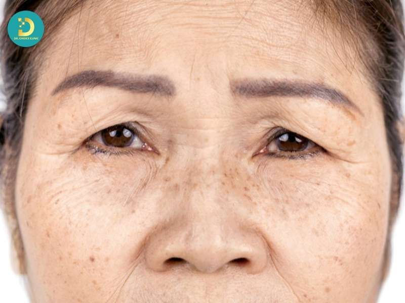 Các vấn đề da phổ biến nhất ở tuổi trung niên và nguyên nhân gốc rễ