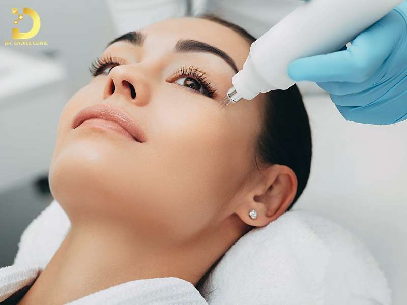 Công nghệ laser tái tạo bề mặt da