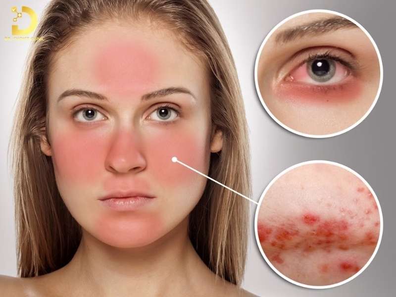 Da nhạy cảm là da gì? 