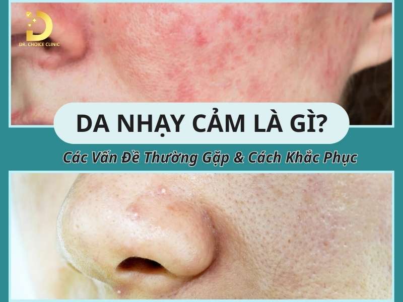 Da nhạy cảm là gì? 