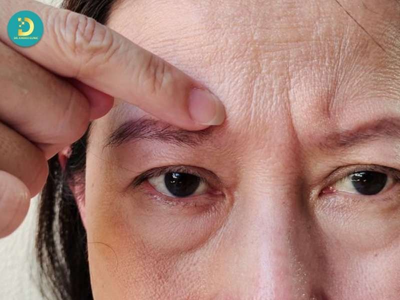 Da tuổi trung niên là gì? hiểu đúng bản chất sinh học của làn da sau 40