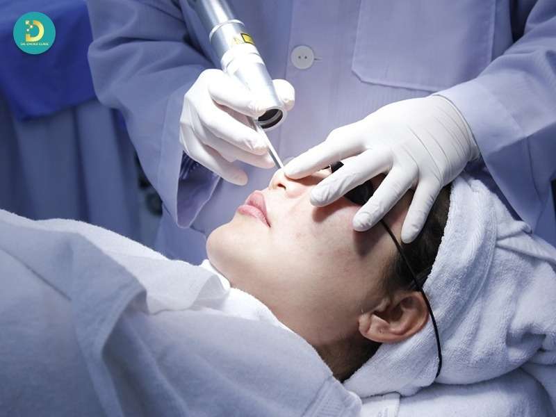 Điều trị rối loạn sắc tố da bằng công nghệ y khoa (tại Clinic/Bệnh viện)