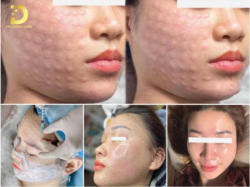 Đơn vị nào cung cấp dịch vụ trẻ hóa da mặt chuyên nghiệp, uy tín tại Hồ Chí Minh?