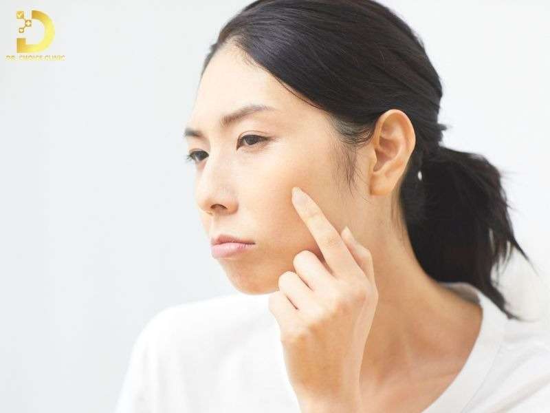 Lưu ý gì khi chăm sóc da nám tại nhà để ngăn ngừa tái phát?