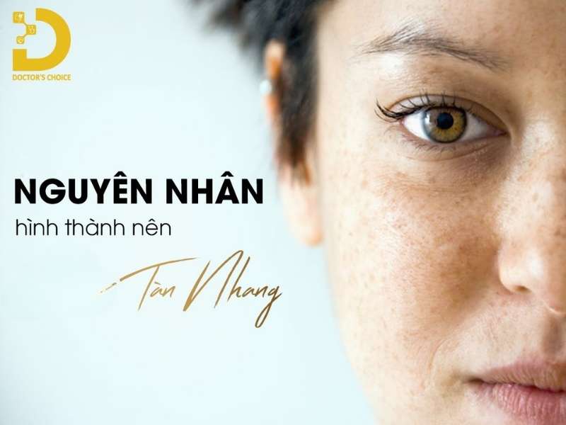 Nguyên nhân nào kích thích sự hình thành các đốm tàn nhang?