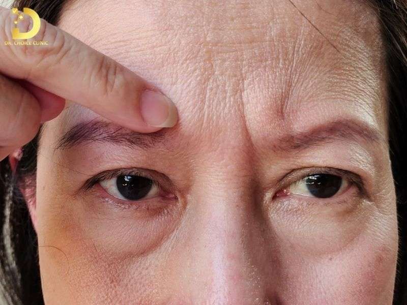 Nếp Nhăn: Nguyên Nhân, Biểu Hiện & Phương Pháp Cải Thiện Hiệu Quả 10 Nguyên nhân ngoại sinh (tác động từ môi trường và lối sống)