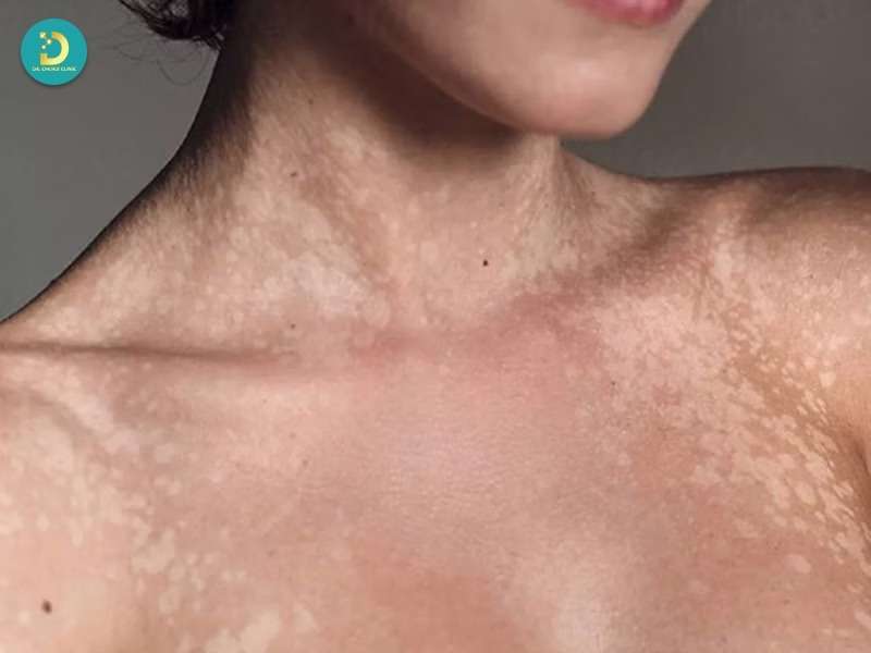 Nguyên nhân nội sinh (bên trong cơ thể)