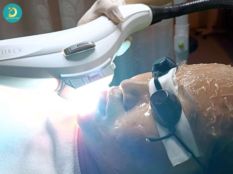 Những công nghệ da liễu thường được lựa chọn để xử lý thâm đỏ