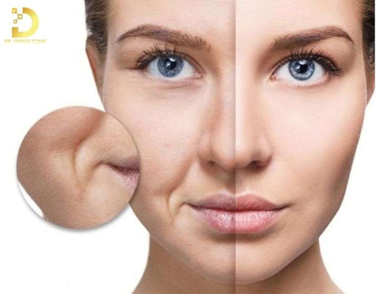 Nếp Nhăn: Nguyên Nhân, Biểu Hiện & Phương Pháp Cải Thiện Hiệu Quả 11 Phân loại nếp nhăn theo mức độ