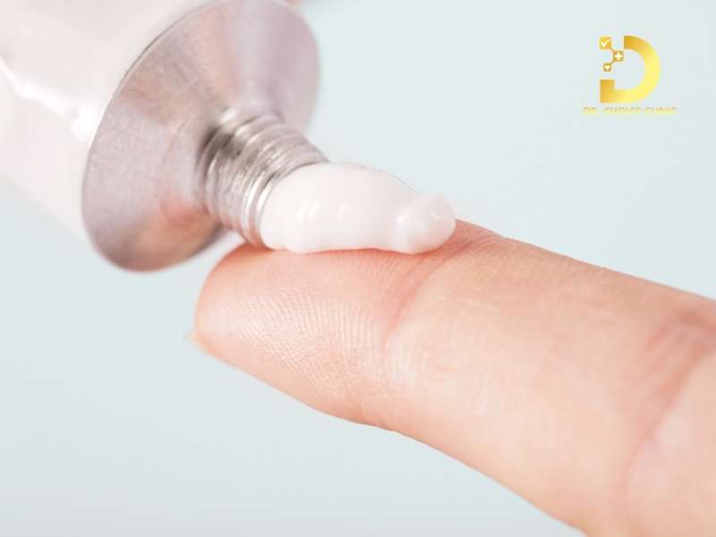 Sử dụng kem bôi hoặc thuốc đặc trị để ức chế sắc tố