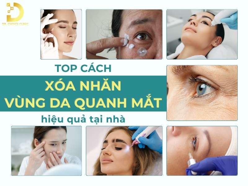 Cách xóa nhăn vùng da quanh mắt hiệu quả 