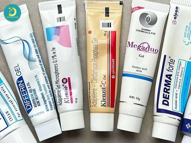 Top kem trị mụn tốt, phổ biến và được tin dùng 