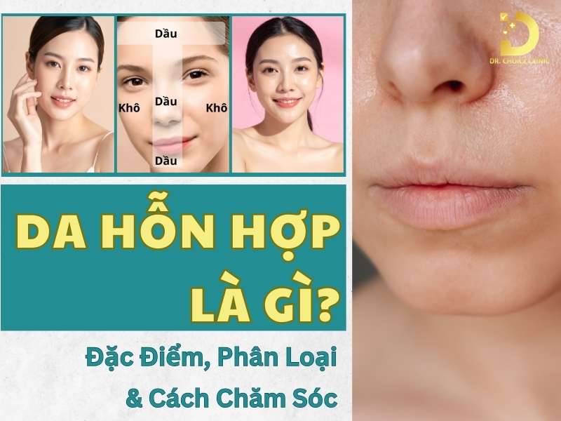 Da hỗn hợp là gì? 