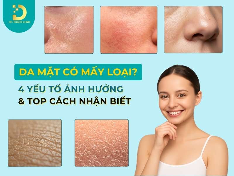 Da mặt có mấy loại? 