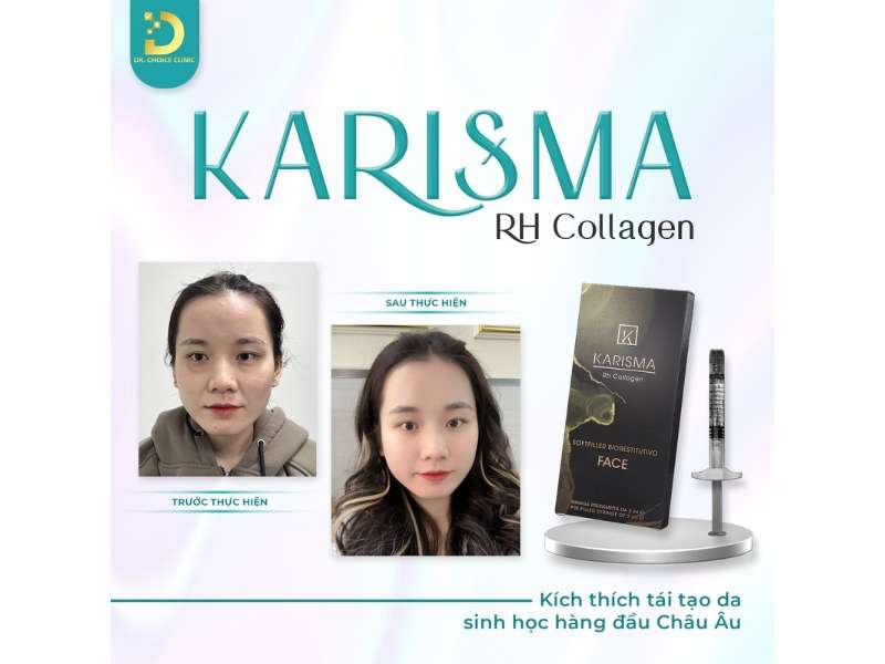 Địa chỉ nào trẻ hóa da uy tín tại HCM?