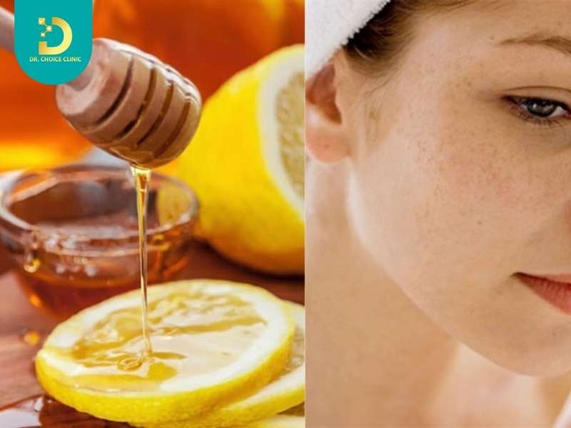 Mặt nạ chanh và mật ong