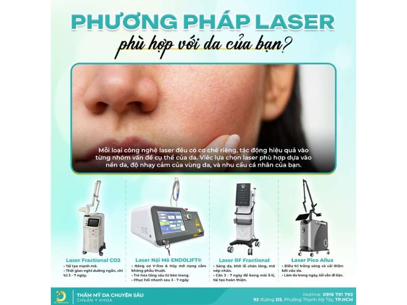 Nhóm công nghệ laser