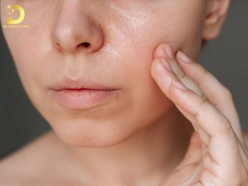 Sai lầm phổ biến khi chăm sóc da hỗn hợp