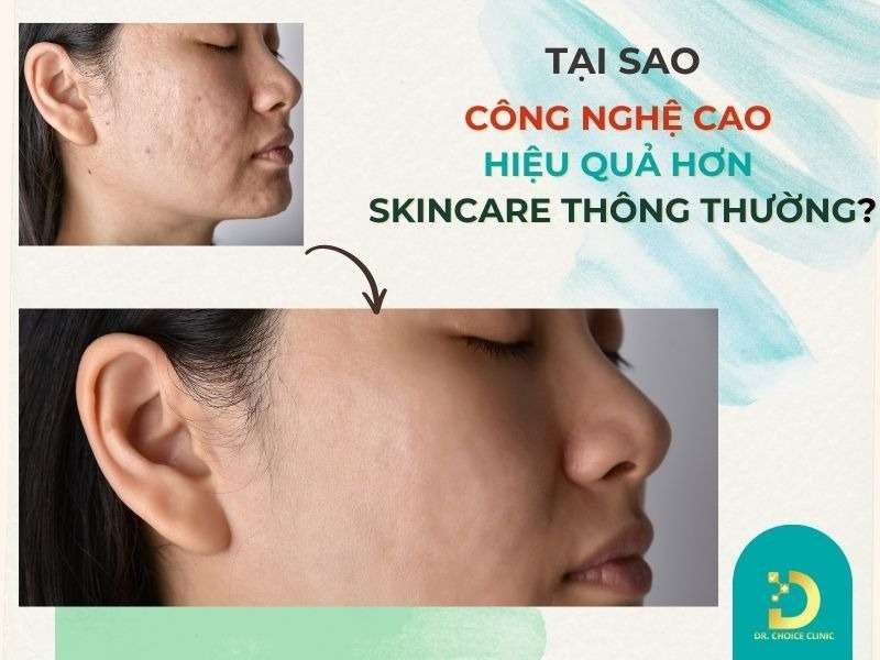 Tại sao công nghệ cao hiệu quả hơn skincare thông thường?