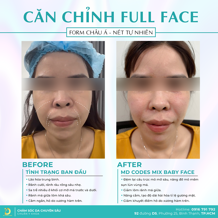 1 can chinh mat drc298