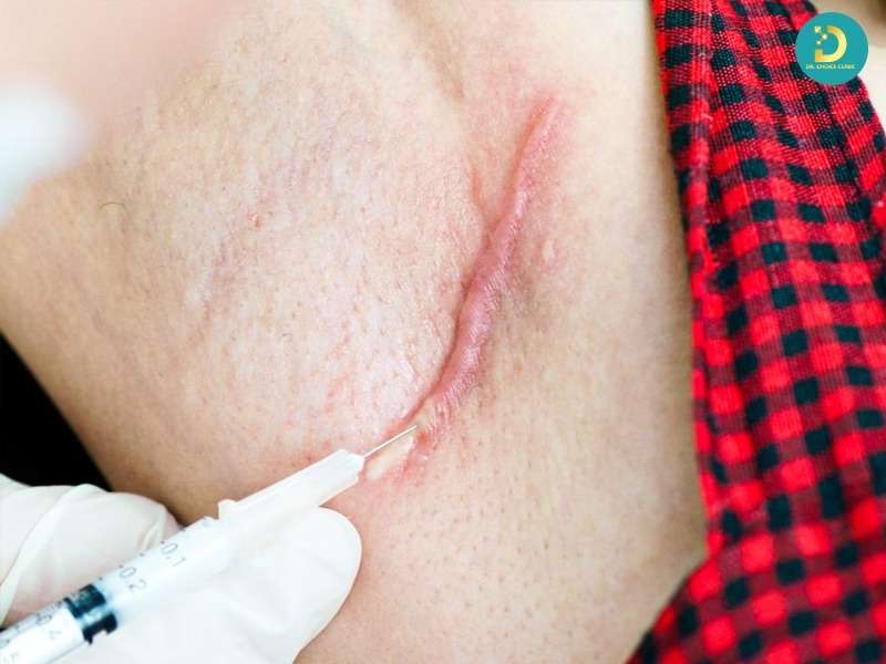 Các phương pháp phối hợp bổ trợ