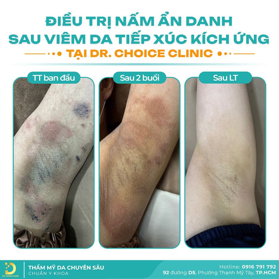 nam da Khach VDCD 2026 1