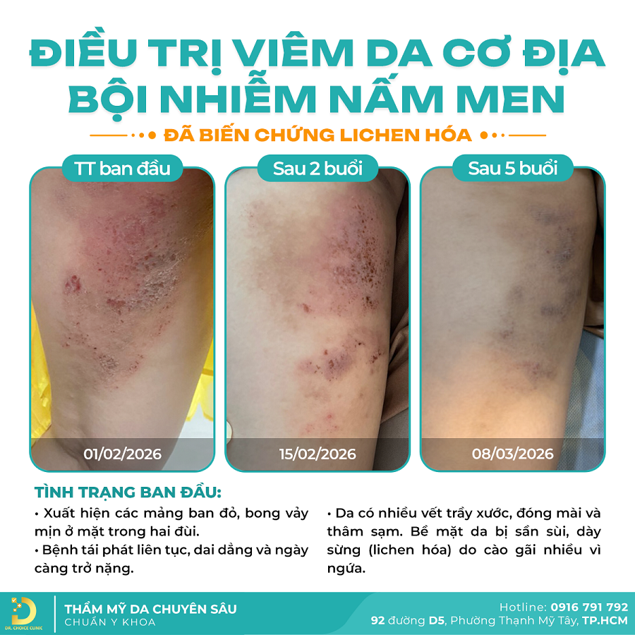 nam da Khach VDCD 2026 2