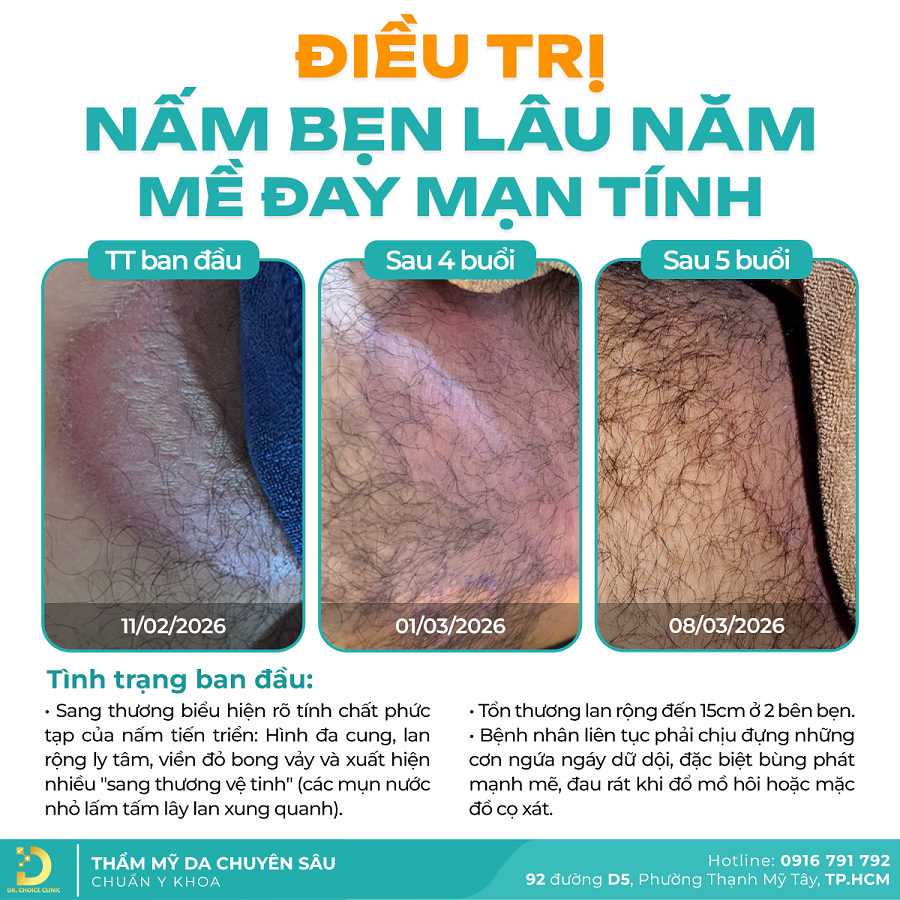 nam da Khach nam da 2026 3