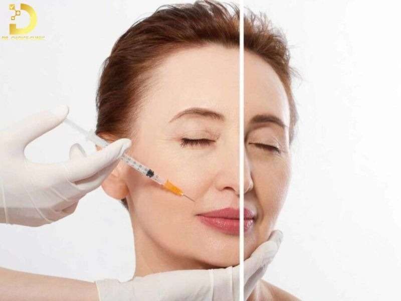 Tiêm filler và botox khác nhau như thế nào?