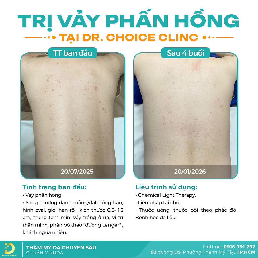 vay Khach vay nen 2026 1