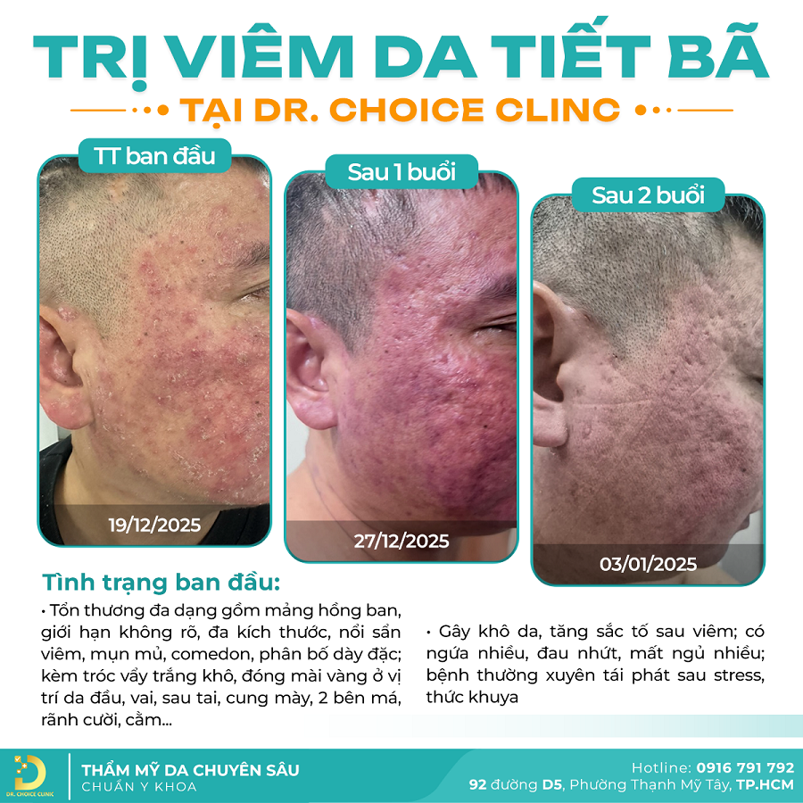 viem da Khach VDCD 2026 3