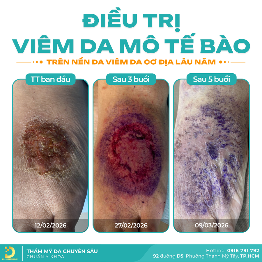 viem da Khach nam da 2026 2