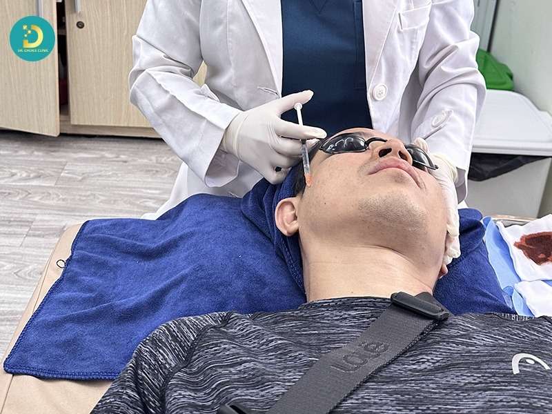 Nhóm meso phục hồi chuyên sâu (đi vào trung bì)