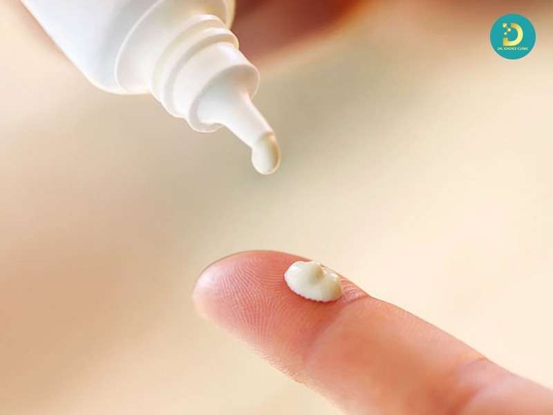 Cách hạn chế sẹo và thâm sau điều trị