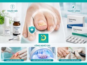 co nhung phuong phap dieu tri nam mong nao duoc dr. choice clinic ap dung