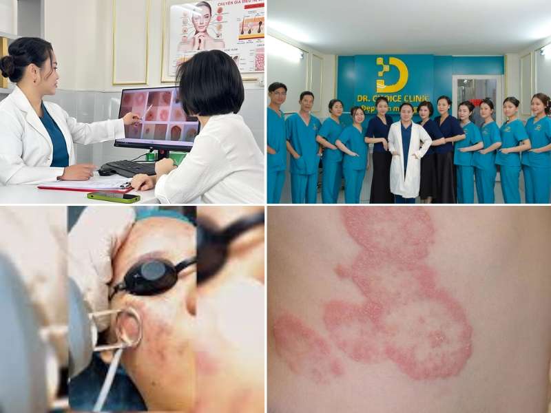 Địa chỉ nào điều trị nấm thân mình uy tín, hiệu quả tại HCM?