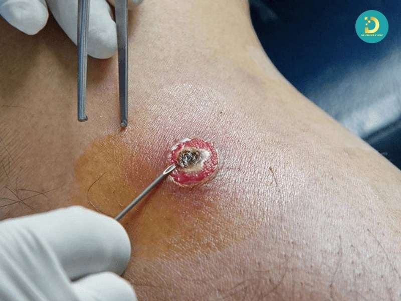 Điều trị can thiệp y khoa