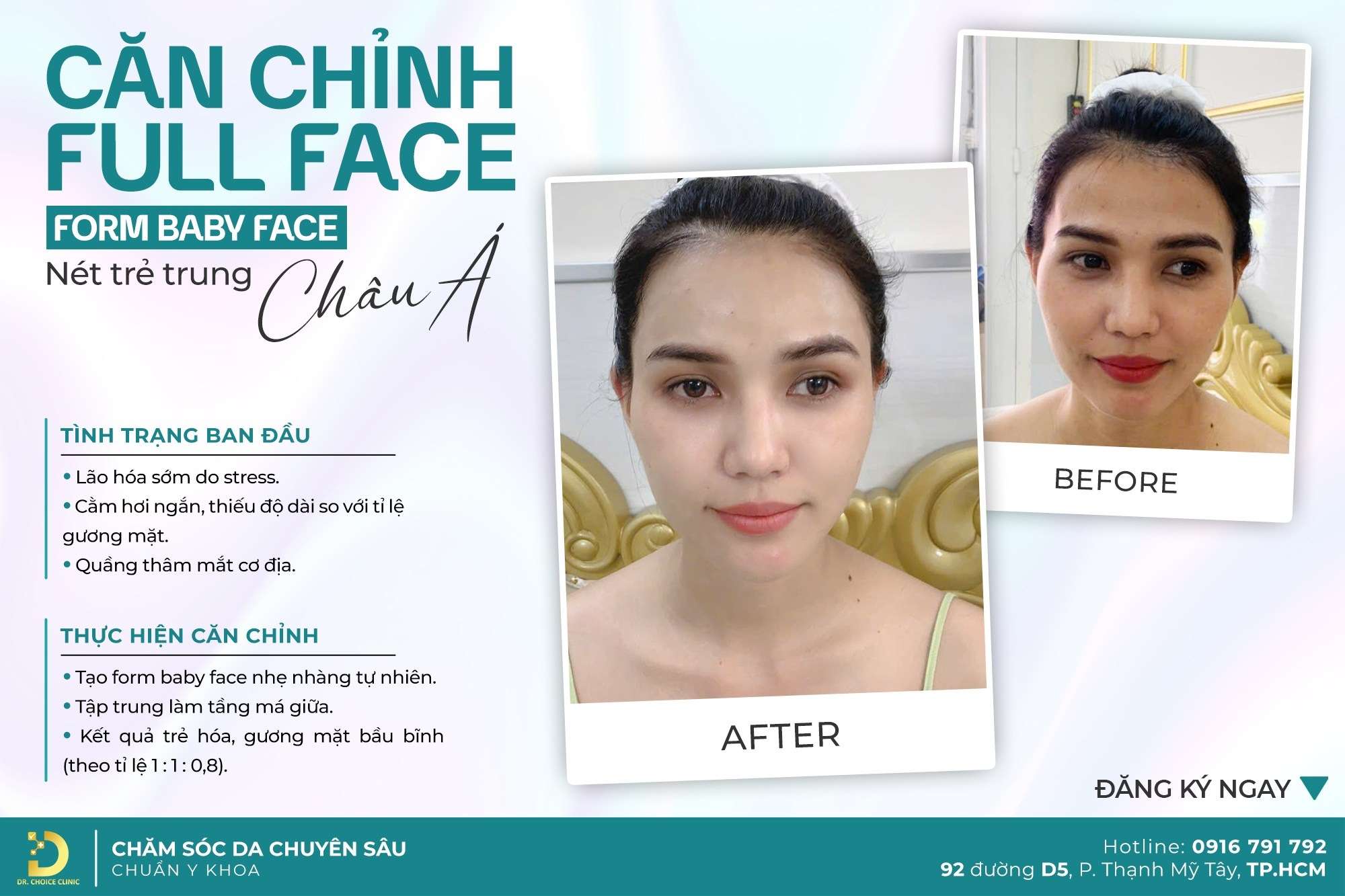 Feedback từ khách hàng đã căn chỉnh khuôn mặt