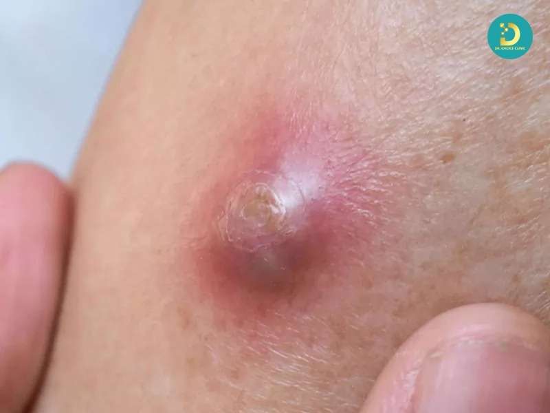 Khi nào cần kết hợp nhiều phương pháp?