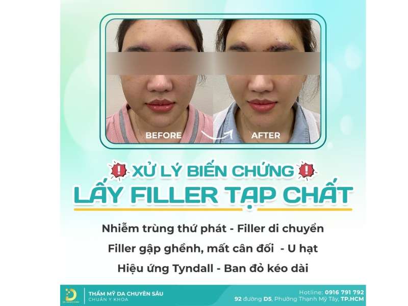 Lý do gì Dr. Choice được nhiều khách hàng lựa chọn?
