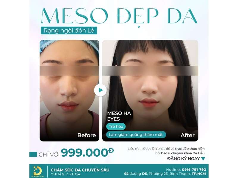 meso chăm da đón lễ