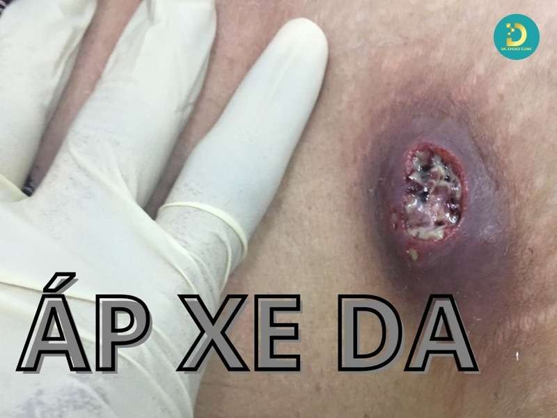 Mức độ nguy hiểm và biến chứng có thể gặp