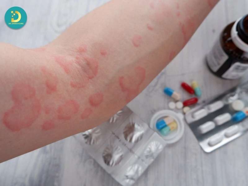 Nguyên tắc sử dụng thuốc an toàn, có theo dõi đáp ứng rõ ràng