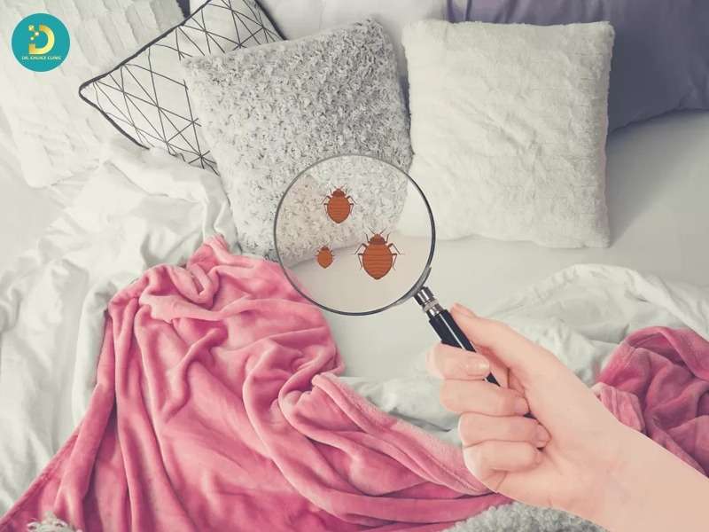 Những yếu tố quyết định hiệu quả điều trị nấm da đầu