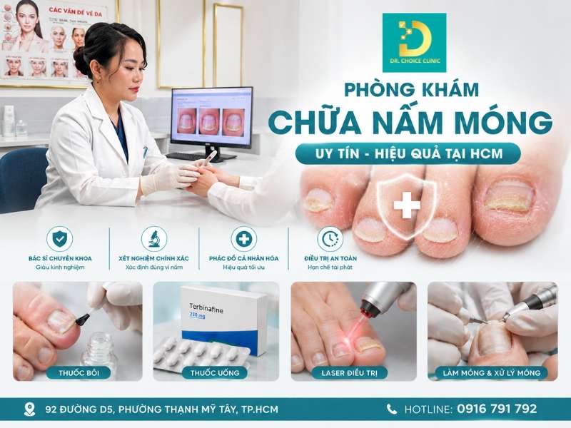 Phòng khám chữa nấm móng uy tín hiệu quả HCM