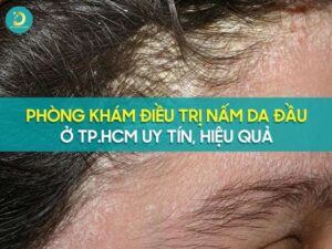 Phòng khám điều trị nấm da đầu ở tp.HCM uy tín