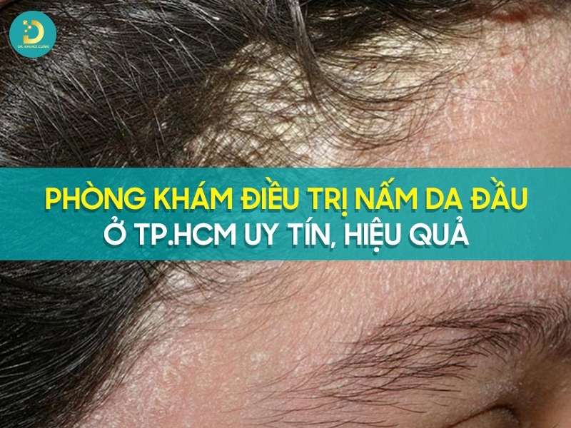 Phòng khám điều trị nấm da đầu ở tp.HCM uy tín
