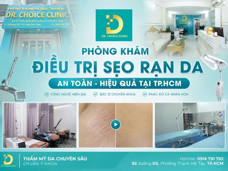 Phòng khám điều trị sẹo rạn da an toàn
