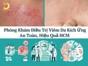 Phòng khám điều trị viêm da kích ứng an toàn